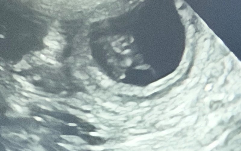 Ultraschallbild eines Welpen